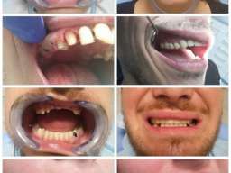 Stomatoloska ordinacija sokobanja