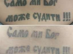 Lasersko skidanje tetovaza