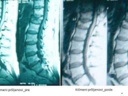 Lecenje kostiju i zglobova
